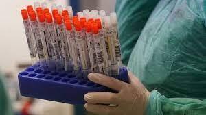 آنفولانزا در کمین افراد  بی توجه به توصیه های پزشکی